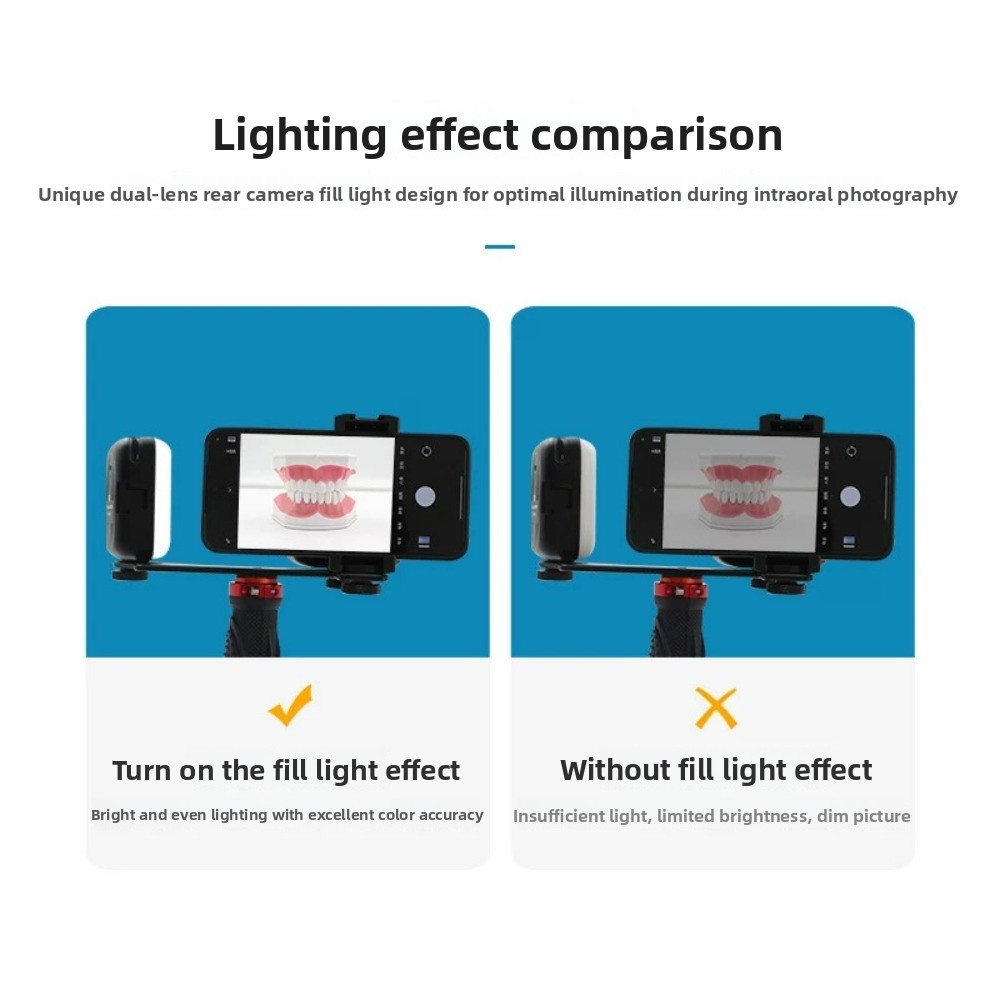 Dental Photography Light, Blue - Photography Lighting Portable のレビューと価格