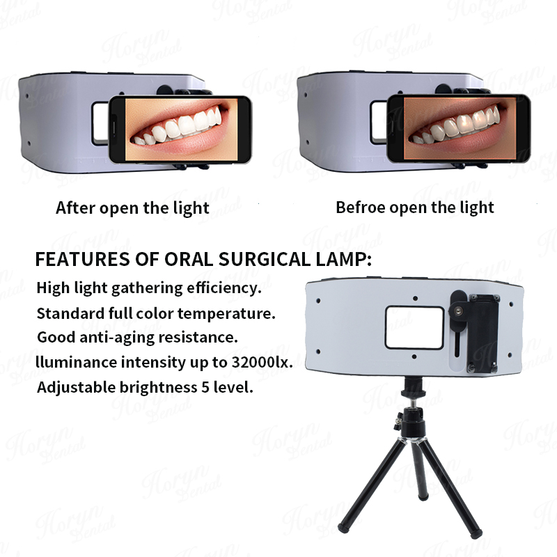 Dental Flash Light Photography - Photography Lighting With Flash のレビューと価格